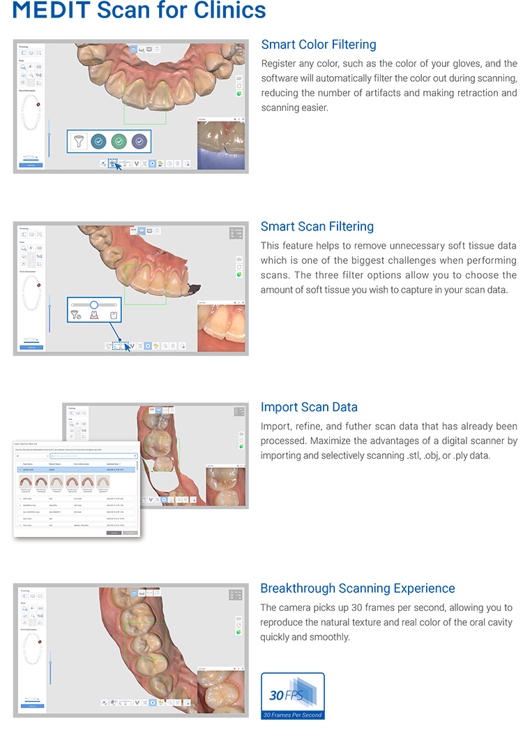 i500 Intraoral Scanner